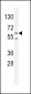 PRKAA2 (Thr172) Antibody  (Center)
